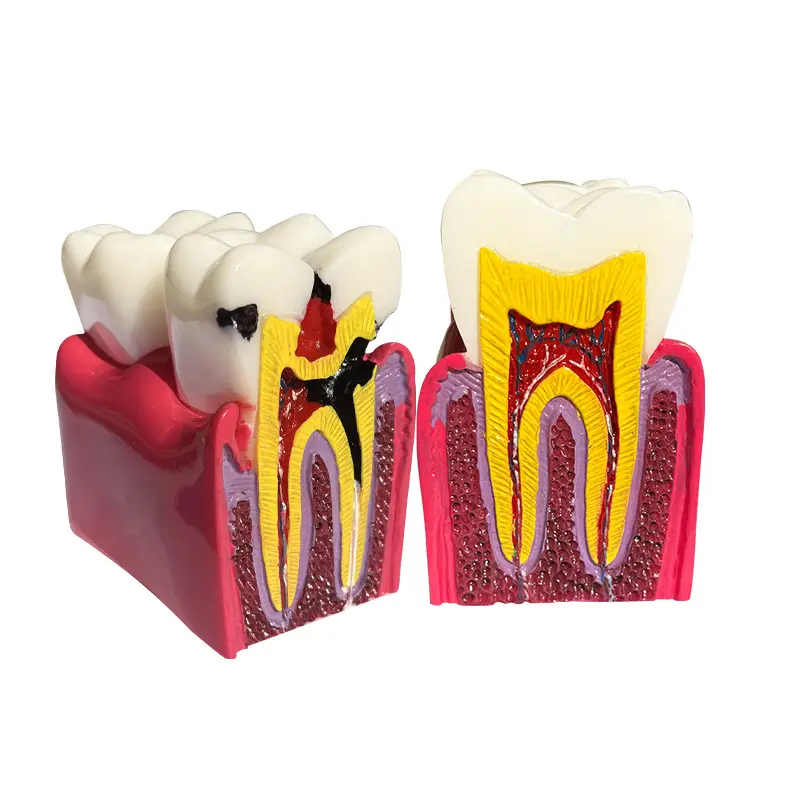 modelo de patología dental